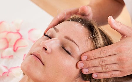Facial Revitalisation (Cosmetic Acupuncture)